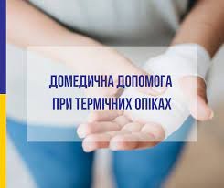 Домедична допомога при опіках. Рекомендації МОЗ